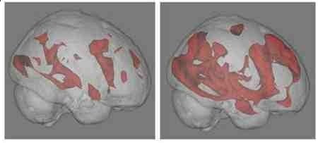 gary_small_brain