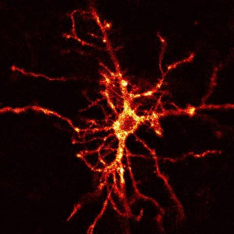 Dopamine receptor: hebbe hebbe hebbe!