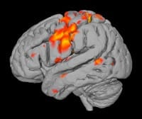 Neuromarketing