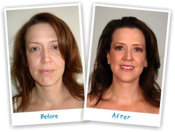 wrinkle-cream-case-study-before-after