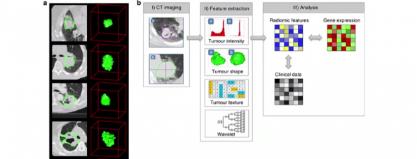 Tumor herkenning deep learning