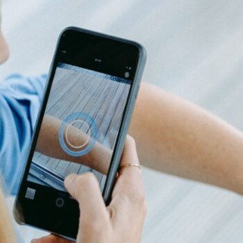 Technologie kan artsen ontlasten bij opsporing huidkanker