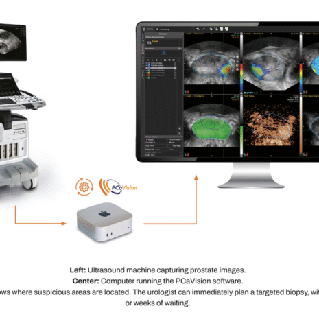 PCaVision sluit op 9 december investeringsronde voor AI-gedreven prostaatkankerdiagnostiek