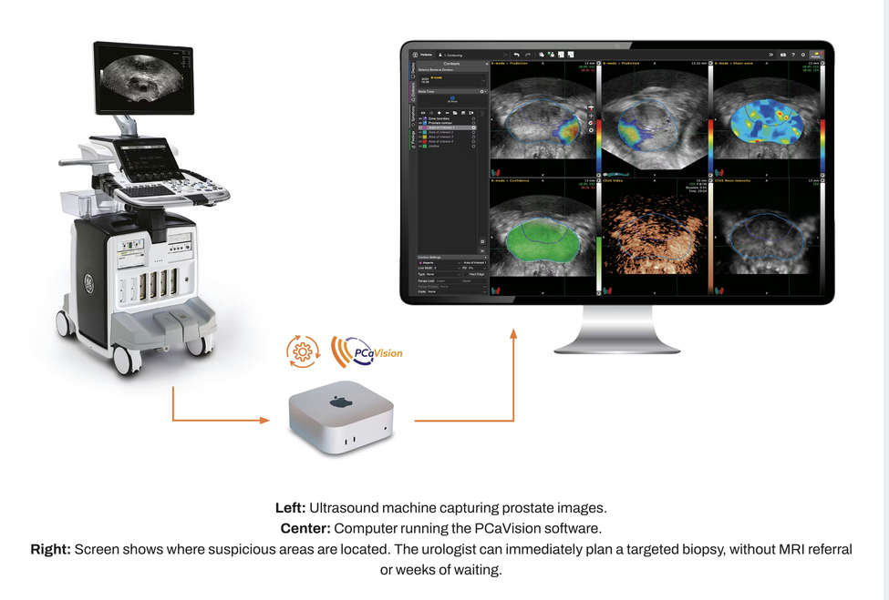 PCaVision sluit op 9 december investeringsronde voor AI-gedreven prostaatkankerdiagnostiek